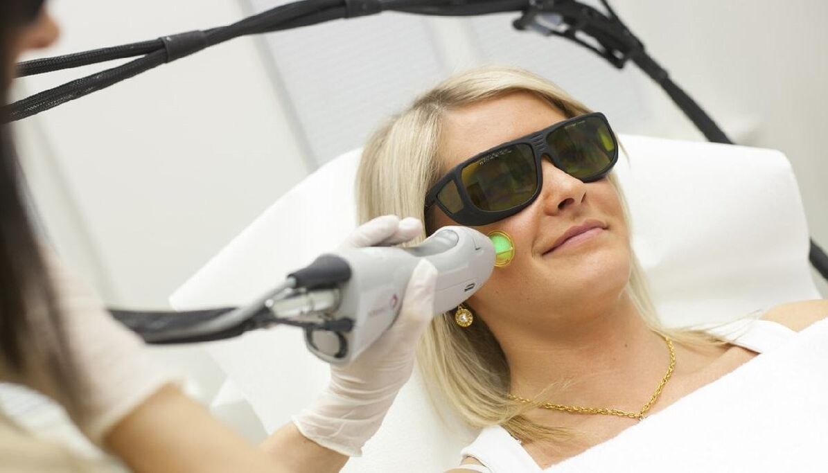 Laser rejuvenation