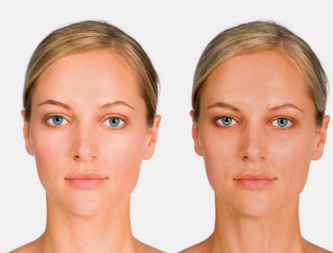 Face before and before you rejuvenate